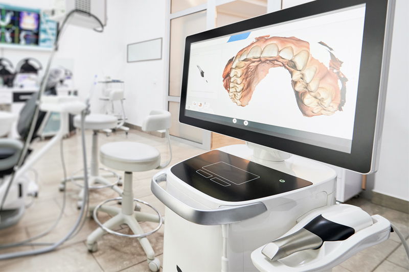 Intra-Oral Scanner in Covington